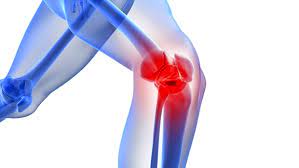 2607.Proposal for a 3-Month Protocol for Knee Rehabilitation - DrSous.Ca