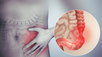 3109.Irritable Bowel Syndrome - DrSous.Ca